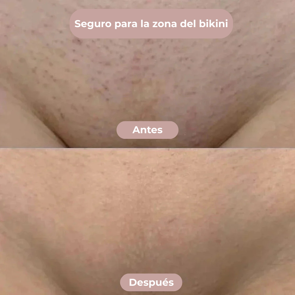 Rasuradora 2 en 1 Calirev