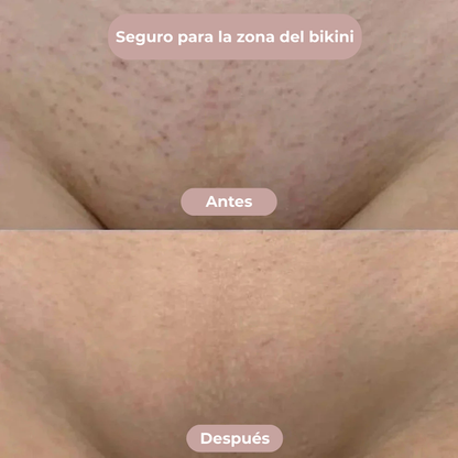 Rasuradora 2 en 1 Calirev